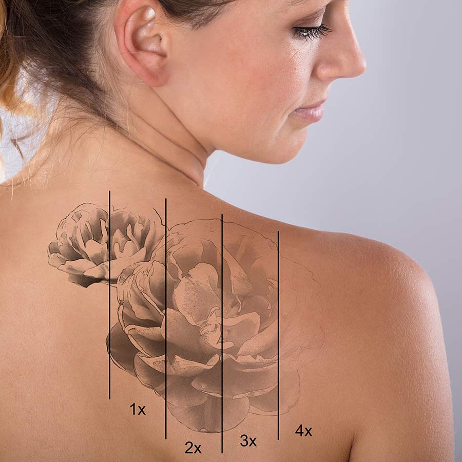 What Are the Ideal Tattoo Needle Sizes on Skin for Different Designs?